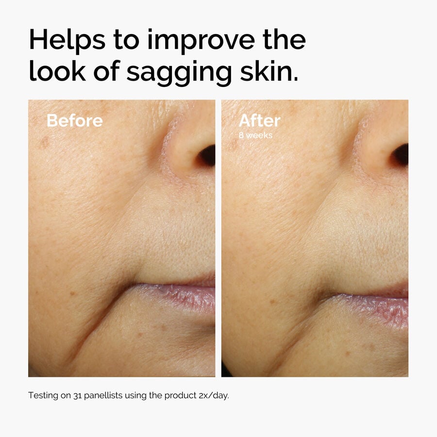 caffeine-3-escin-1-face-serum-d9 ord-caffeine-3pct-escin-1pct-face-serum-before-after-sagging.jpg
