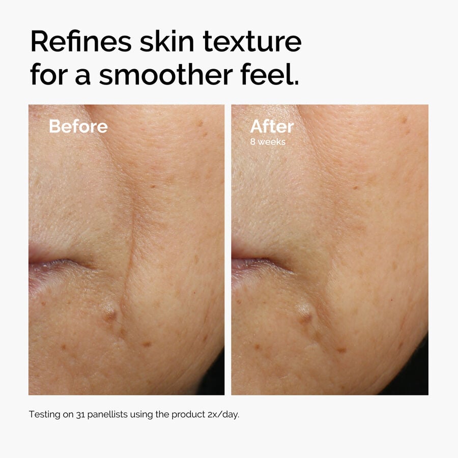 caffeine-3-escin-1-face-serum-d9 ord-caffeine-3pct-escin-1pct-face-serum-before-after-texture.jpg