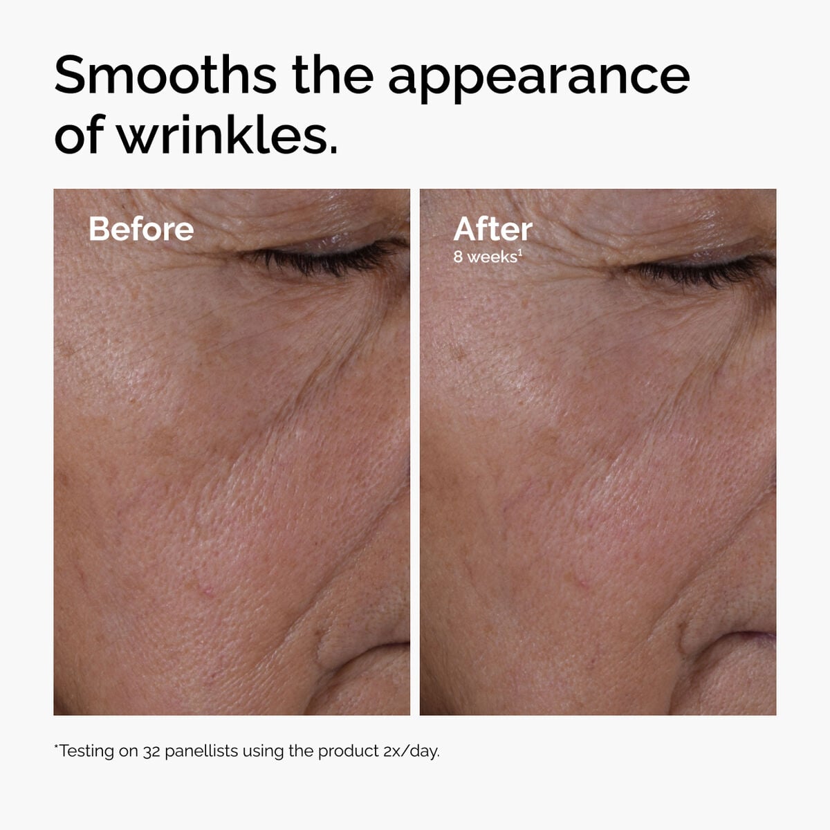 multi-peptide-ha-serum-y0 ord-multi-peptide-ha-serum-wrinkles-before-after.jpg