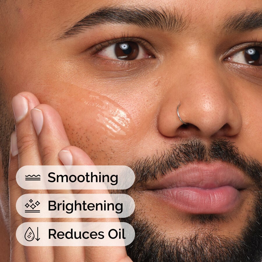 niacinamide-10-zinc-1-b4 ord-niacinamide-10-zic-1-model-application-with-benefits.jpg